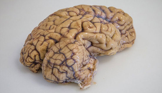 نخستین مدل مجازی مغز ساخته شد