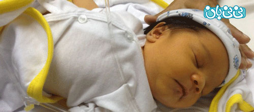 زردی نوزاد؛ از تشخیص تا درمان