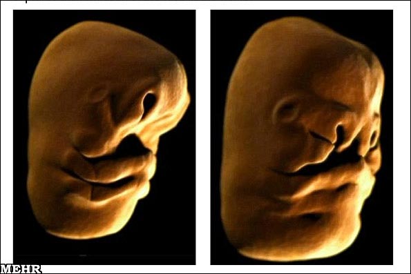 اولین انیمیشن از نحوه تکامل صورت در جنین