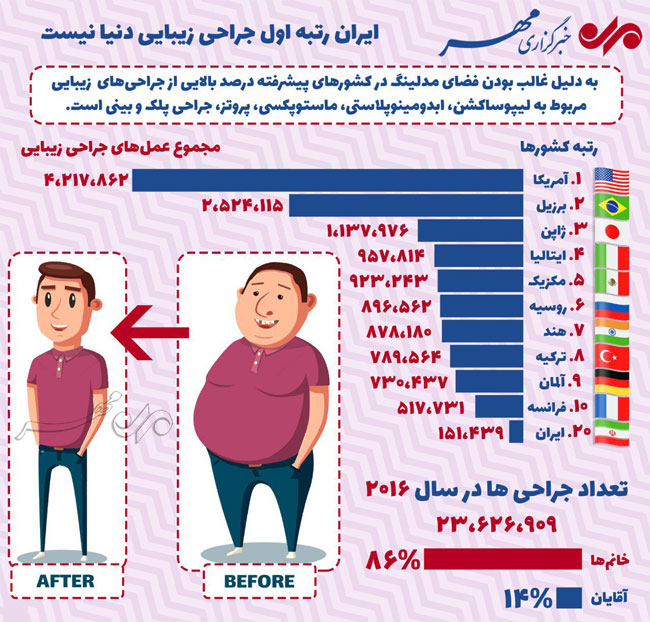 اینفوگرافی؛ ایران رتبه اول جراحی زیبایی دنیا نیست