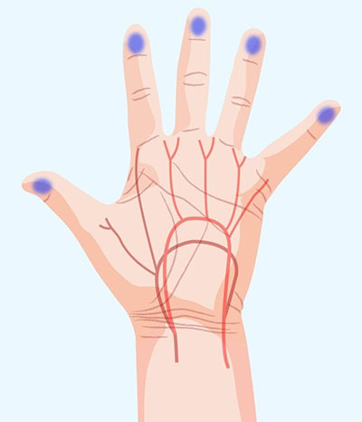 دست ها چه چیزهایی درباره سلامت ما می گویند؟