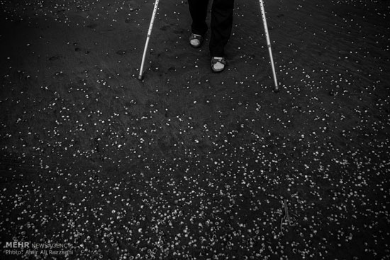 عکس: زندگی با پاهای نقره ای