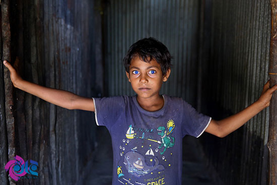کودکی با چشمان حیرت آور +عکس