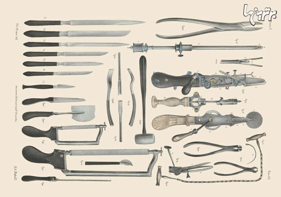 عمل های جراحی در قرن نوزدهم +عکس