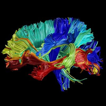 چند قدم تا دستیابی به قوی‌ترین مغز مصنوعی