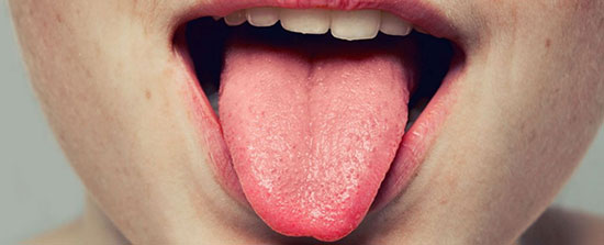 نشانه‌های سرطان روی زبان!