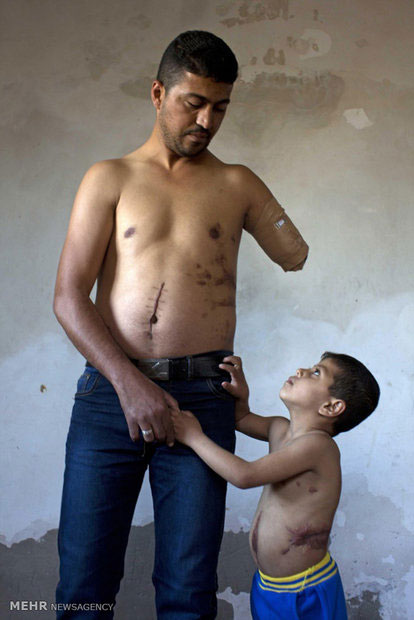 عکس: هزینه های انسانی جنگ غزه (12+)