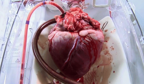تصویر متحرک: قلب انسان این‌ طور می‎زند