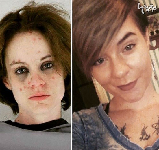 تصاویری از قبل و بعد از ترک کردن مواد مخدر