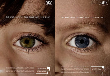 فیلم: سرطان چشم در کودکان را به راحتی تشخیص دهید