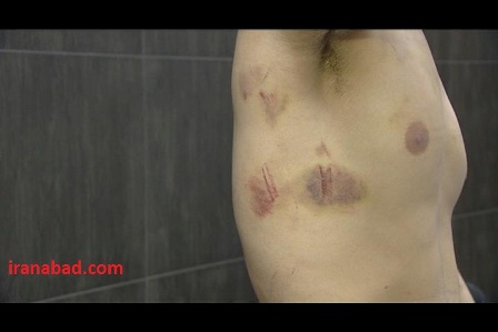 تصاویری از شکنجه جوان ایرانی در سوریه