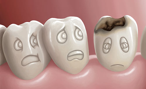 عفونت‌های دندانی را در نطفه خفه کنید