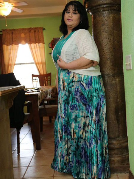 سنگین‌ترین زن دنیا 300 کیلو لاغر کرد! +عکس