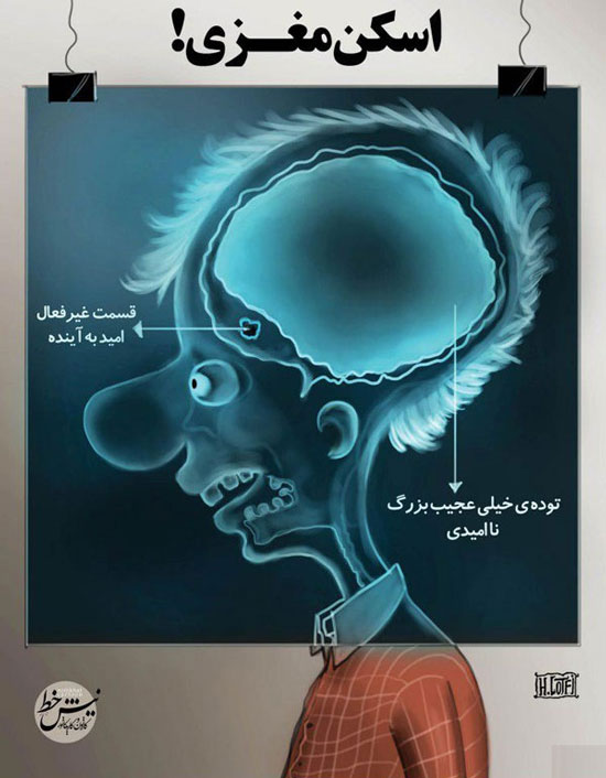 کاریکاتور؛ اسکن مغزی یک ایرانی در شرایط کنونی