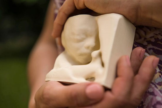 مادران نابینا تصویر سونوگرافی جنین را «ببینند»