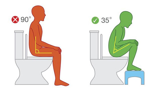 کدام توالت برای سلامتی بهتر است؛ فرنگی یا سنتی؟