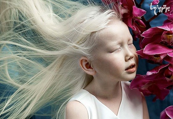 زیبایی منحصربفرد و شگفت انگیز «سفیدبرفی سیبری»