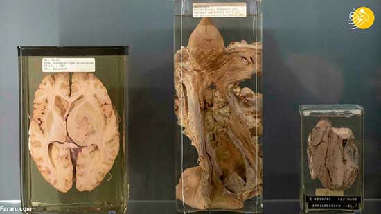 نمایشگاه عجیب از اعضای بدن انسان