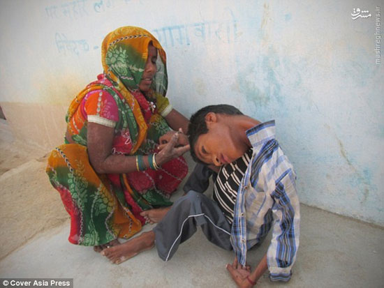 عکس: پسر 12 ساله هندی با سرِ برعکس