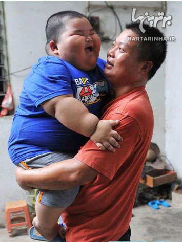کودک سه ساله با 60 کیلوگرم وزن! +عکس