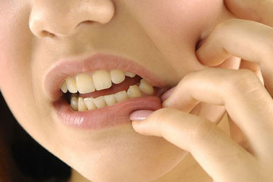 درمان دندان درد در خانه