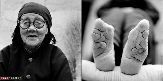 بازماندگان زنان پا کوچک در چین +عکس
