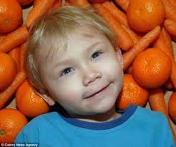 این پسر با خوردن هویج نارنجی می شود!