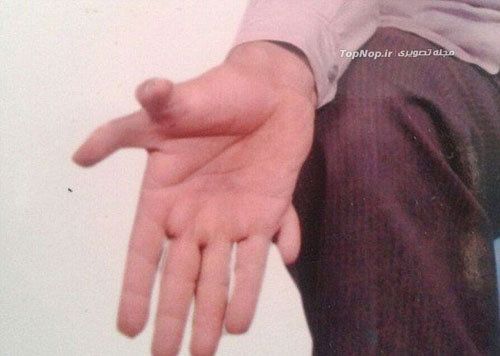 یک مرد هندی با 28 انگشت! +عکس