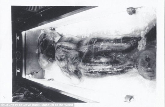 تصاویر باورنکردی از جسد یک «پا گنده»