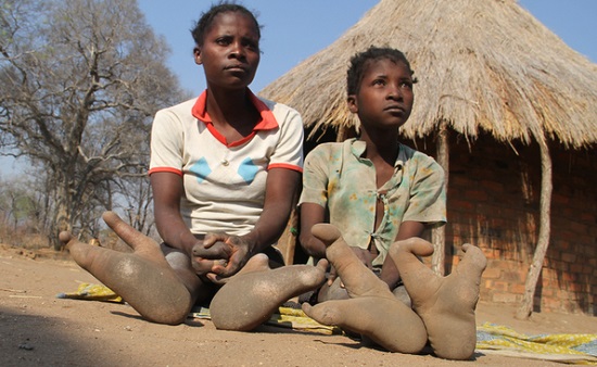 یک قبیله آفریقایی با پاهای عجیب اما واقعی!