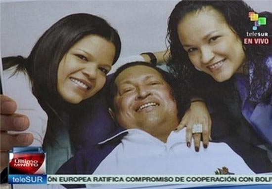 «هوگو چاوز» پس از عمل جراحی +عکس