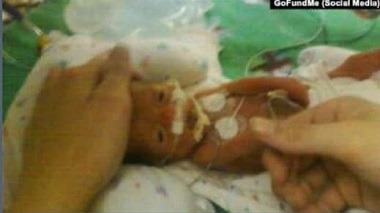 تولد معجزه‌آسای نوزاد ۳۷۰ گرمی در آمریکا