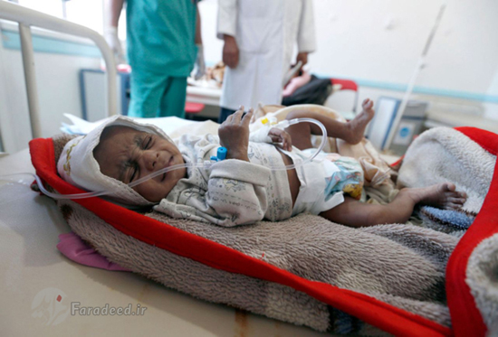 وبا به جان مردم یمن افتاد