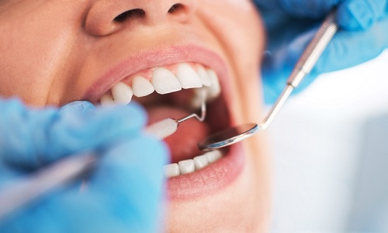 سلامت دهان و دندان با ۴ مکمل طبیعی