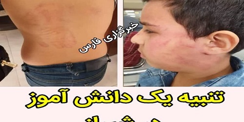 تنبیه بدنی یک دانش‌آموز در شیراز