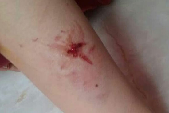 حمله سگ‌های ولگرد به یک خانم در لواسان