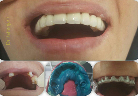 خدمات متفاوت دندانپزشكی در كرج