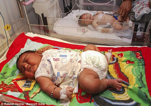 عکس: سنگین ترین نوزاد به دنیا آمد