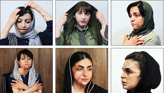 دختران شین‌آباد: صورتمان را به ما برگردانید