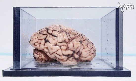 مشهورترین مغز جهان